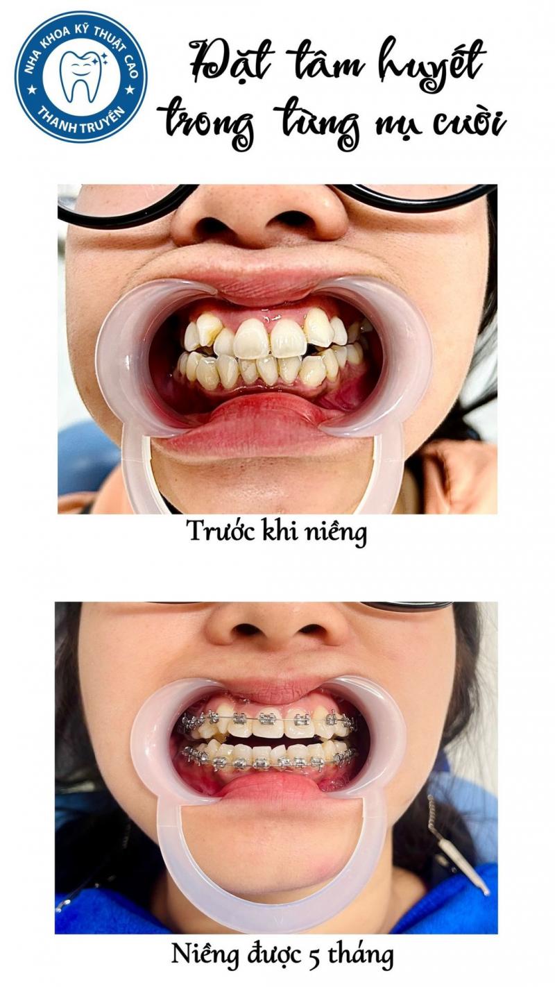 Nha Khoa Bs.Truyền Trà Vinh